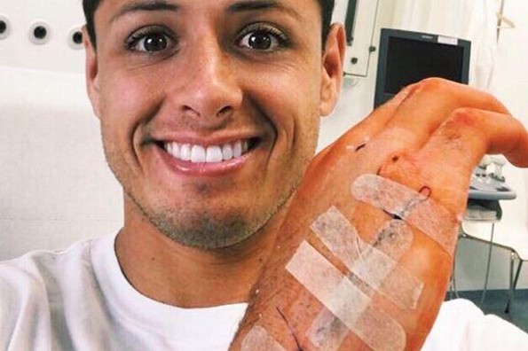 ¡Así quedó! Javier “Chicharito” Hernández muestra su mano tras la operación (FOTO)