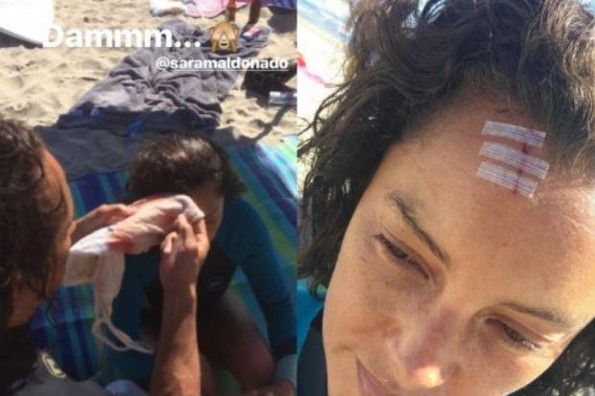 Sara Maldonado sufre accidente durante sus vacaciones (+FOTOS)