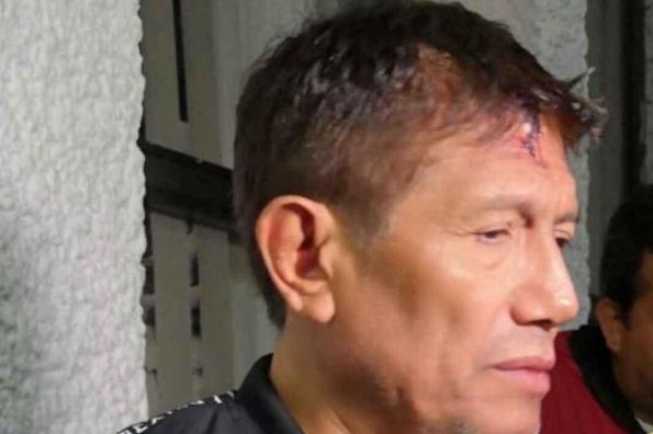 Juan Osorio sufre asalto en su propia casa #VIDEO