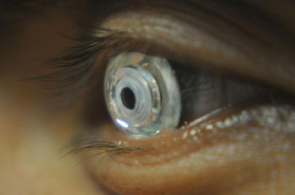 Diseñan lentes de contacto con zoom al pestañear