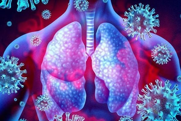 EPOC y COVID-19 ¿combinación fatal?