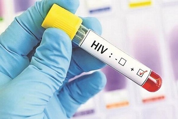 Proyecto Mosaico en la última fase de vacuna contra el VIH/SIDA