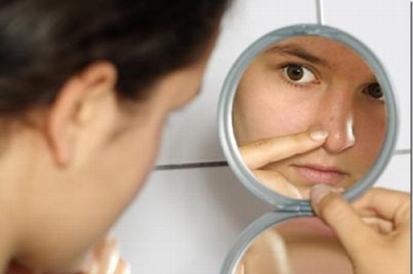 Descubre todo lo que tus espinillas revelan sobre tu salud