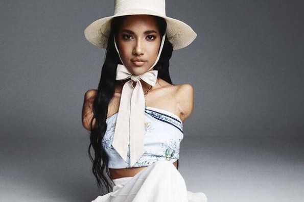 Victoria Salcedo, modelo con discapacidad que lucha por la inclusión en Miss Universo
