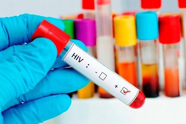 Vacuna experimental contra VIH/Sida da buenos resultados en animales
