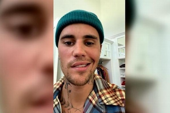Justin Bieber tiene paralizada media cara; pide oraciones