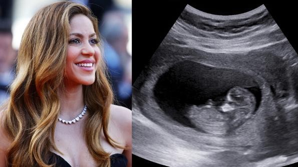 ¡Shakira está embarazada! Vídeo desata rumores