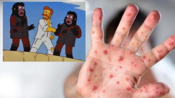 ¡Lo que nos dejó el Carnaval! Reportan primer caso de viruela de mono en Veracruz