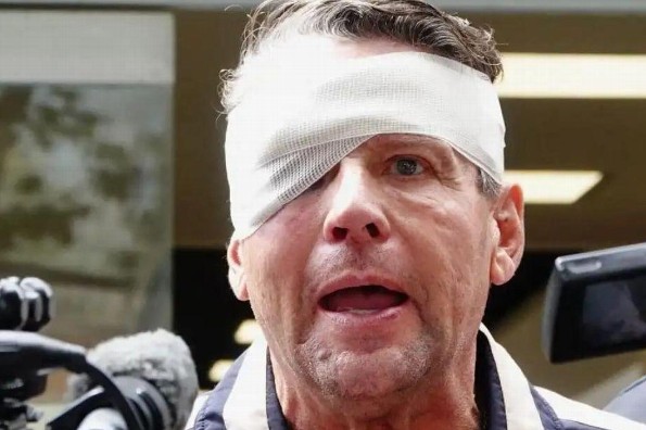 Alfredo Adame resultó con cuatro fracturas faciales tras golpiza 