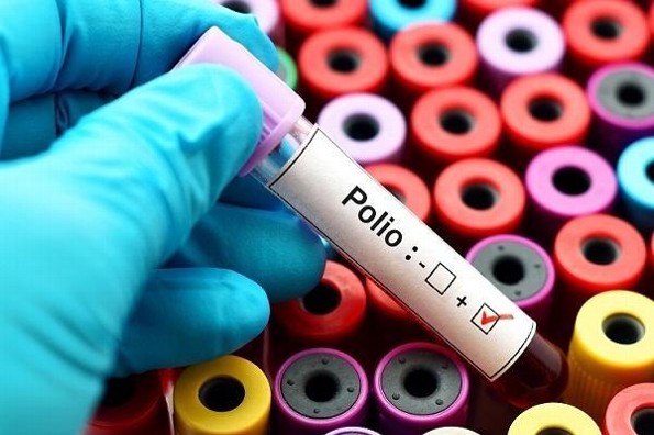Lo que debes saber sobre la poliomielitis (+foto)