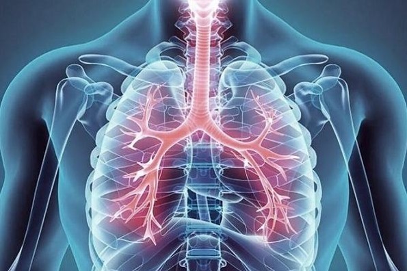 Síntomas de la Enfermedad Pulmonar Obstructiva Crónica (EPOC)