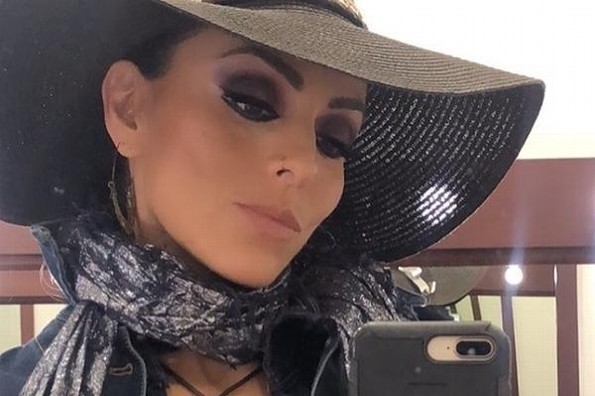 Ivonne Montero sufre trágico accidente en su ojo (+fotos)