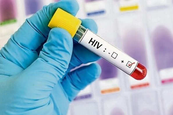 VPH y VIH, un binomio de alto riesgo 
