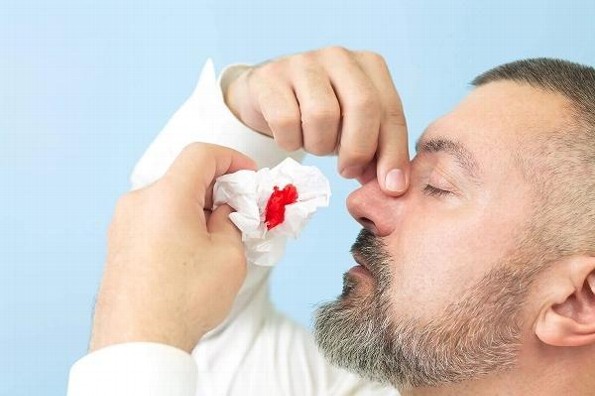 Piden poner atención a sangrados de nariz