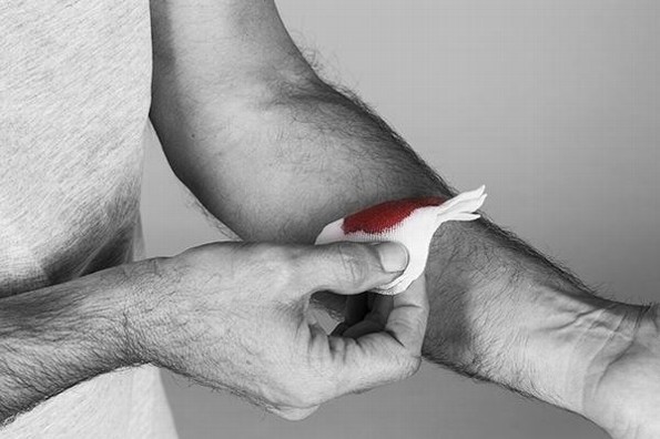 ¿Qué es la hemofilia y cuáles son los síntomas?