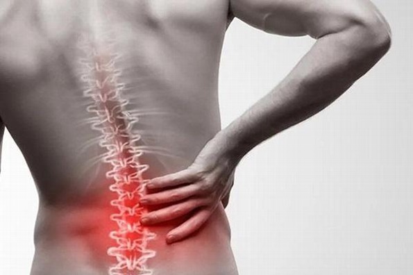 Esto debes saber sobre la lumbalgia
