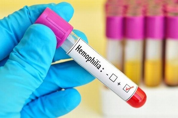 ¡Entérate! Estos son los síntomas de Hemofilia 