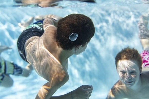 Otitis de verano: Afección común en época de calor que podría provocar sordera 