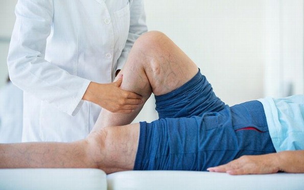 ¿Tienes varices? ¡Aquí te mostramos algunos tratamientos que te pueden resultar efectivos!