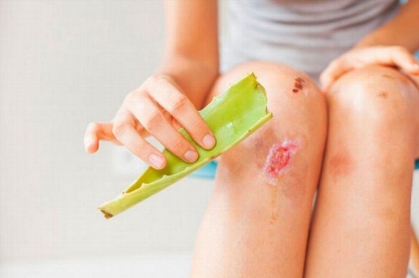 ¿Conocías las propiedades de la sábila? ¡Aquí te las decimos! 