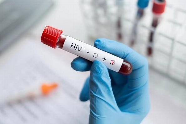 ¡Aprueban medicamento que previene el VIH!