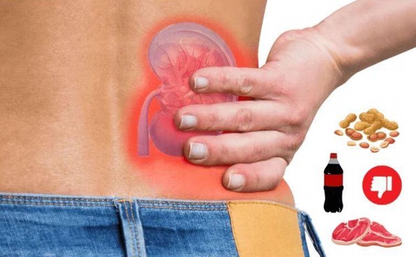 Alimentos que pueden dañar tu riñon ¿Lo sabías? 