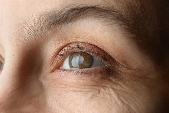 Habrá campaña gratuita de detección del glaucoma en Veracruz; esto te puede interesar