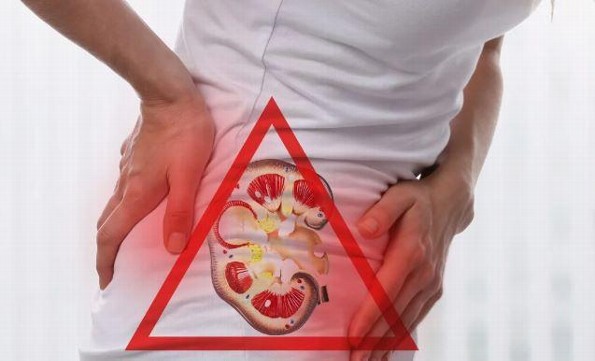 ¡No dejes que el calor te gane la partida! Protégete de las infecciones urinarias 